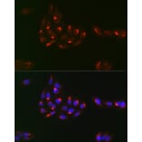 Immunofluorescence - Anti-PDGFR alpha Antibody (A13872) - Antibodies.com