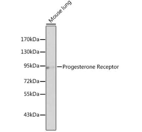 Western Blot - Anti-Progesterone Receptor Antibody (A13873) - Antibodies.com