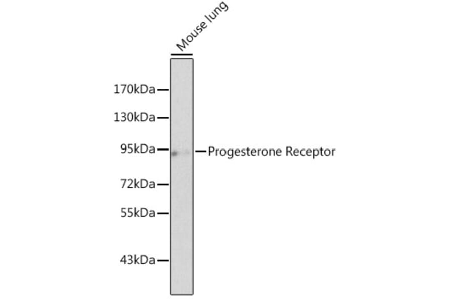 Western Blot - Anti-Progesterone Receptor Antibody (A13873) - Antibodies.com