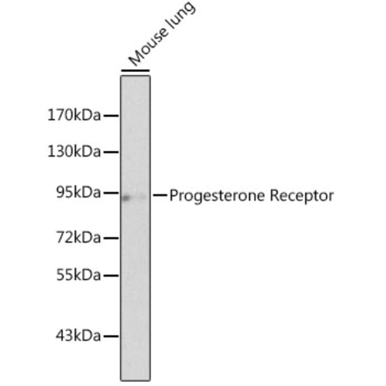 Western Blot - Anti-Progesterone Receptor Antibody (A13873) - Antibodies.com