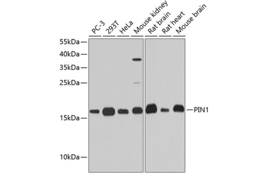 Western Blot - Anti-Pin1 Antibody (A13874) - Antibodies.com