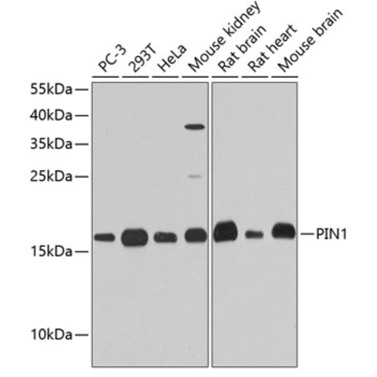 Western Blot - Anti-Pin1 Antibody (A13874) - Antibodies.com
