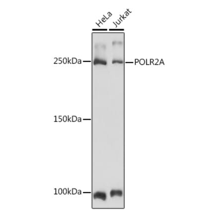 Western Blot - Anti-RNA polymerase II CTD repeat YSPTSPS Antibody (A13875) - Antibodies.com