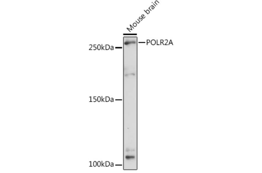 Western Blot - Anti-RNA polymerase II CTD repeat YSPTSPS Antibody (A13875) - Antibodies.com