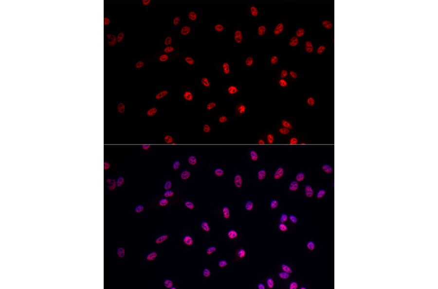 Immunofluorescence - Anti-RNA polymerase II CTD repeat YSPTSPS Antibody (A13875) - Antibodies.com