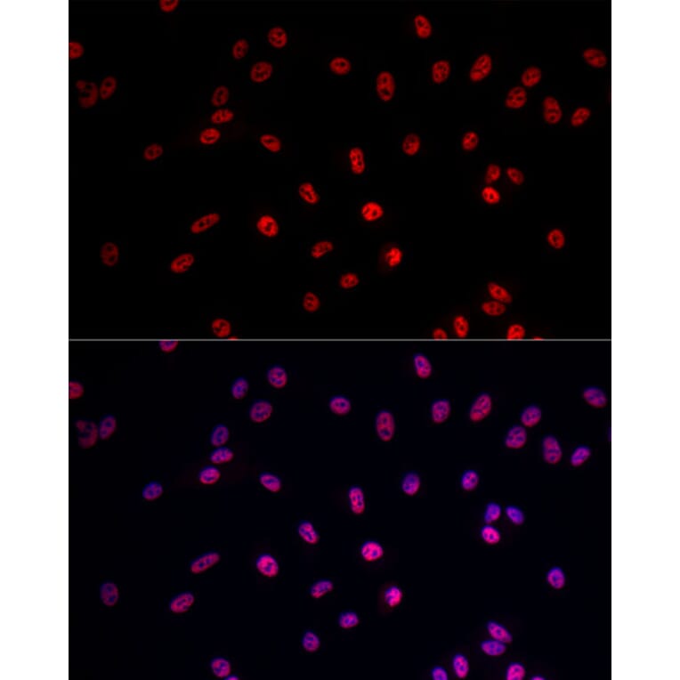 Immunofluorescence - Anti-RNA polymerase II CTD repeat YSPTSPS Antibody (A13875) - Antibodies.com