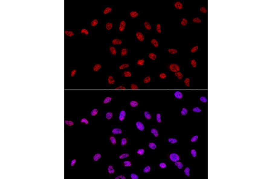 Immunofluorescence - Anti-RNA polymerase II CTD repeat YSPTSPS Antibody (A13875) - Antibodies.com