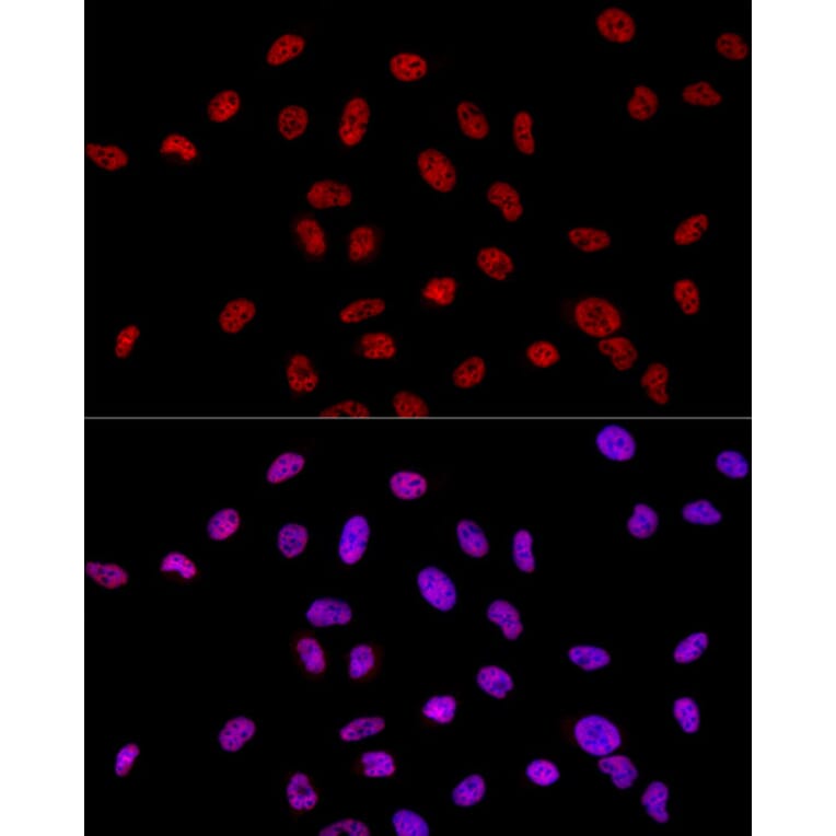 Immunofluorescence - Anti-RNA polymerase II CTD repeat YSPTSPS Antibody (A13875) - Antibodies.com