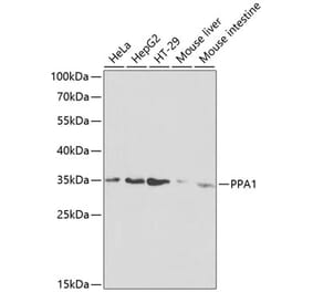 Western Blot - Anti-Pyrophosphatase 1 Antibody (A13876) - Antibodies.com