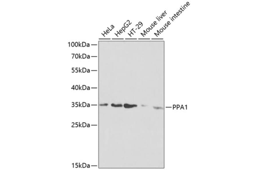 Western Blot - Anti-Pyrophosphatase 1 Antibody (A13876) - Antibodies.com