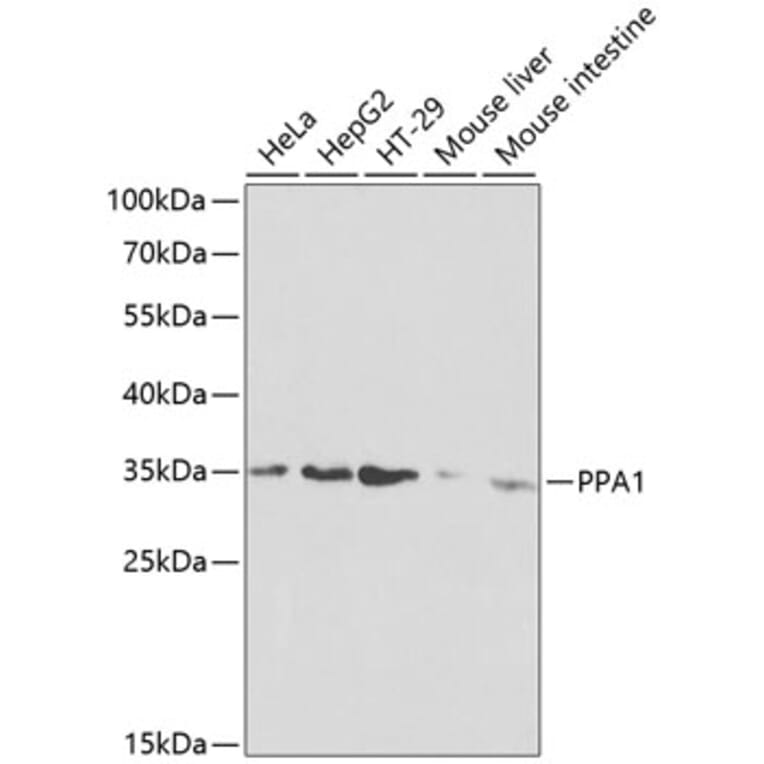 Western Blot - Anti-Pyrophosphatase 1 Antibody (A13876) - Antibodies.com