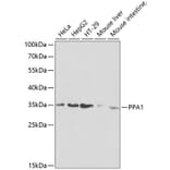 Western Blot - Anti-Pyrophosphatase 1 Antibody (A13876) - Antibodies.com