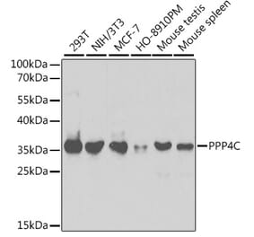 Western Blot - Anti-PP-X Antibody (A13877) - Antibodies.com
