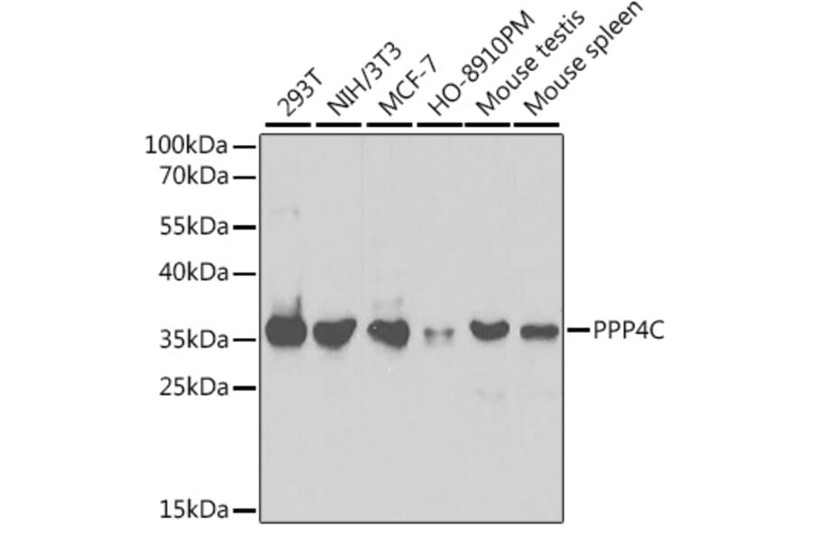 Western Blot - Anti-PP-X Antibody (A13877) - Antibodies.com