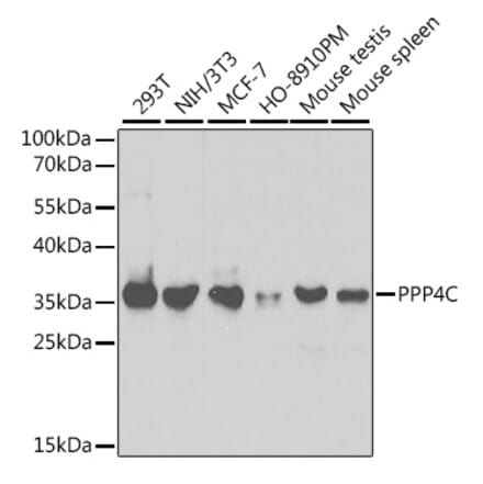 Western Blot - Anti-PP-X Antibody (A13877) - Antibodies.com