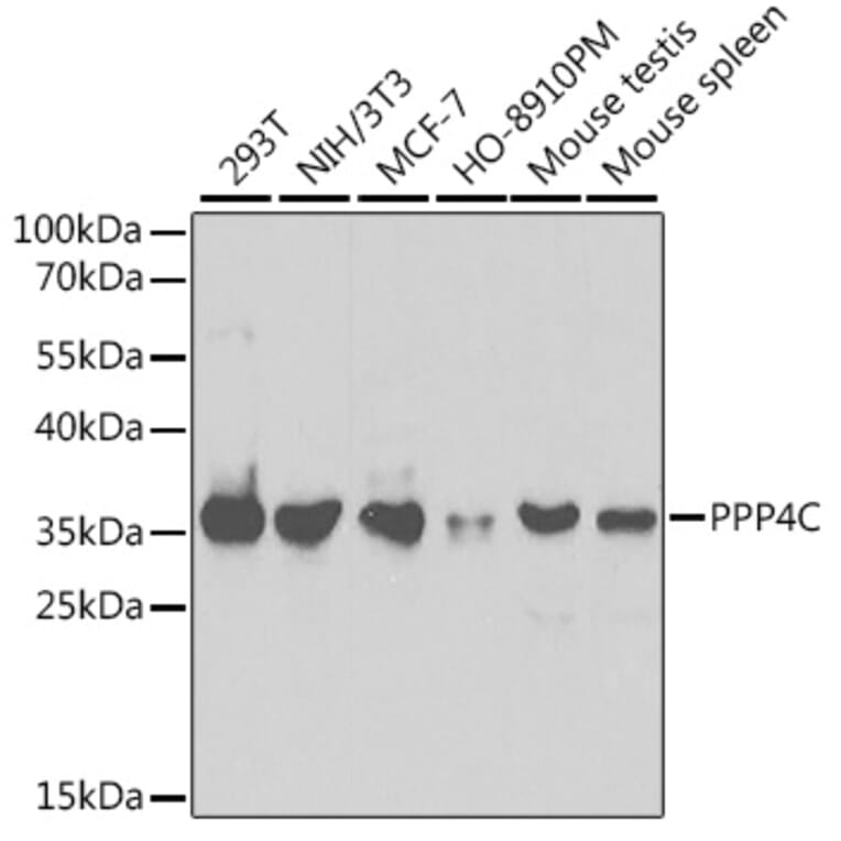 Western Blot - Anti-PP-X Antibody (A13877) - Antibodies.com