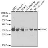 Western Blot - Anti-PP-X Antibody (A13877) - Antibodies.com