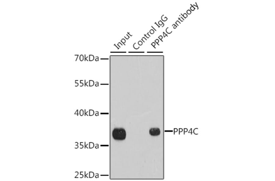 Western Blot - Anti-PP-X Antibody (A13877) - Antibodies.com
