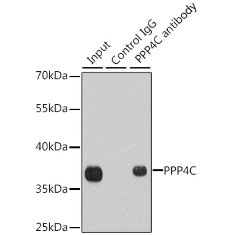Western Blot - Anti-PP-X Antibody (A13877) - Antibodies.com