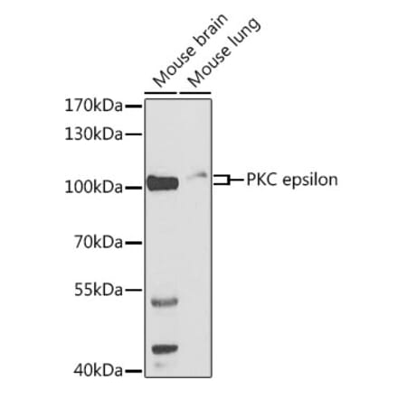Western Blot - Anti-PKC epsilon Antibody (A13878) - Antibodies.com