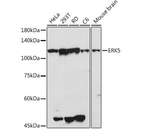 Western Blot - Anti-ERK5 Antibody (A13879) - Antibodies.com