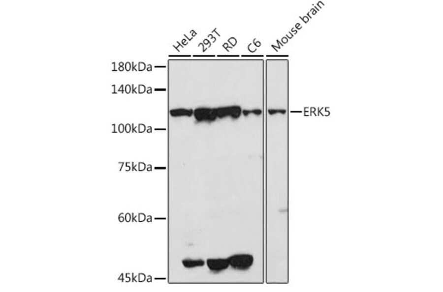 Western Blot - Anti-ERK5 Antibody (A13879) - Antibodies.com