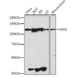 Western Blot - Anti-ERK5 Antibody (A13879) - Antibodies.com