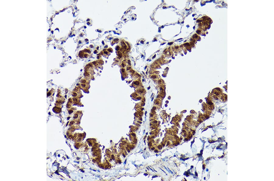 Immunohistochemistry - Anti-ERK5 Antibody (A13879) - Antibodies.com