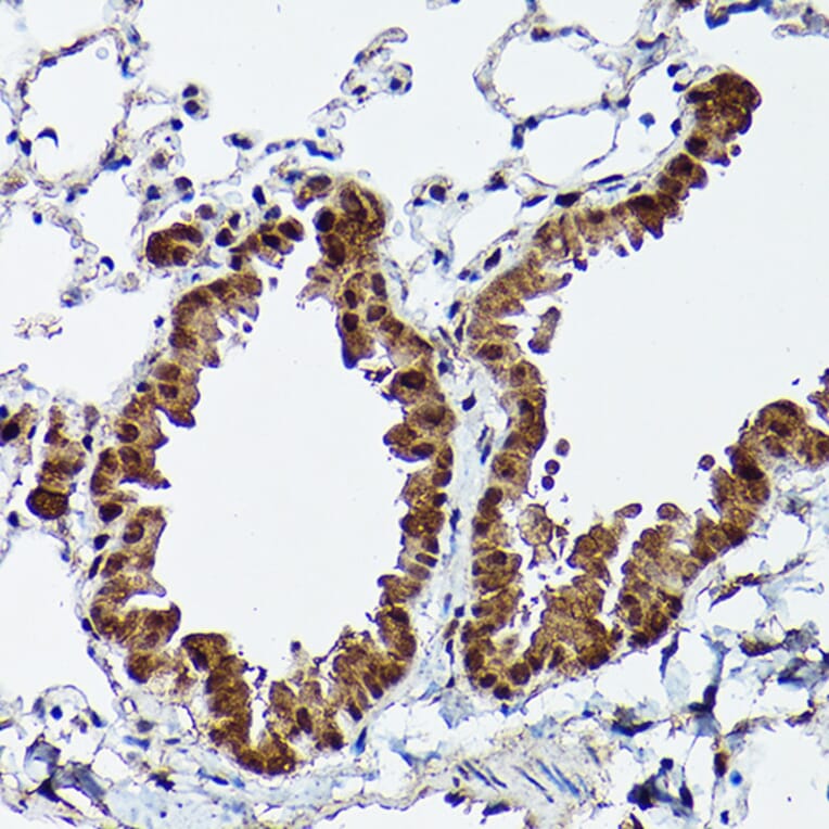 Immunohistochemistry - Anti-ERK5 Antibody (A13879) - Antibodies.com