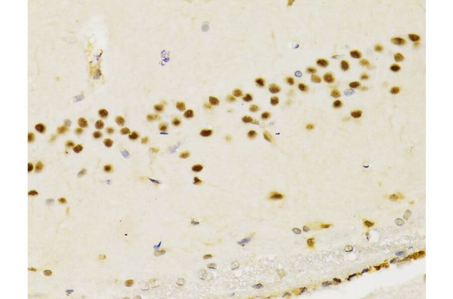 Immunohistochemistry - Anti-PTEN Antibody (A13881) - Antibodies.com