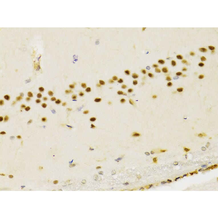 Immunohistochemistry - Anti-PTEN Antibody (A13881) - Antibodies.com