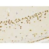 Immunohistochemistry - Anti-PTEN Antibody (A13881) - Antibodies.com