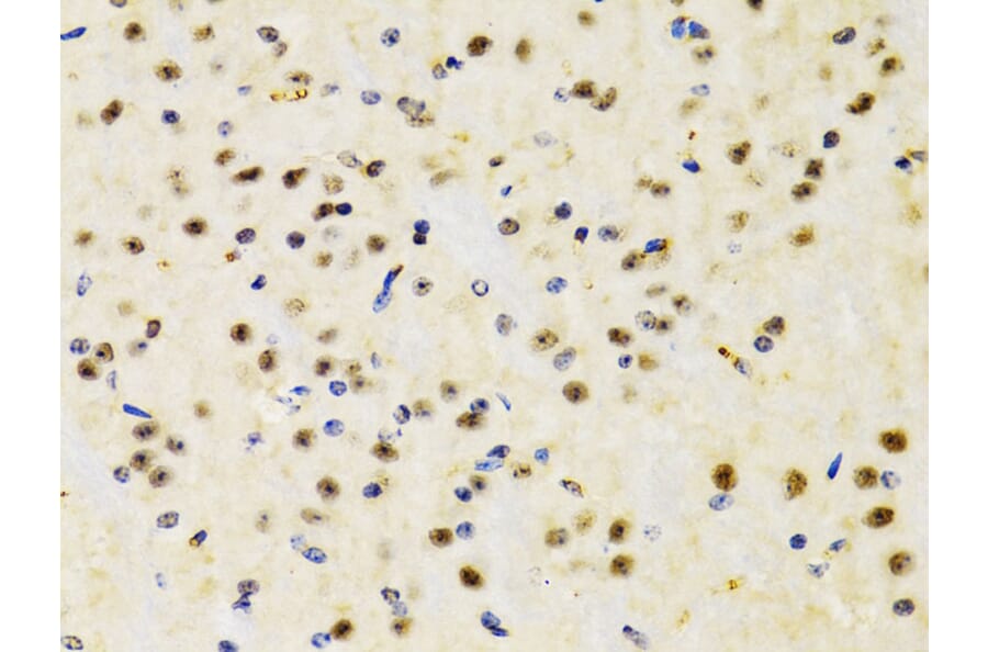 Immunohistochemistry - Anti-PTEN Antibody (A13881) - Antibodies.com