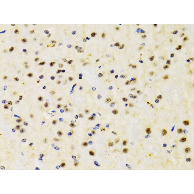 Immunohistochemistry - Anti-PTEN Antibody (A13881) - Antibodies.com