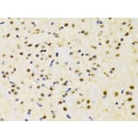 Immunohistochemistry - Anti-PTEN Antibody (A13881) - Antibodies.com