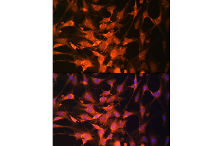 Immunofluorescence - Anti-PTEN Antibody (A13881) - Antibodies.com