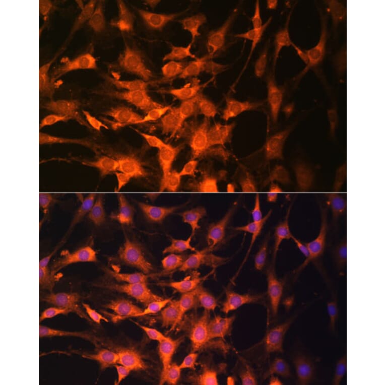 Immunofluorescence - Anti-PTEN Antibody (A13881) - Antibodies.com