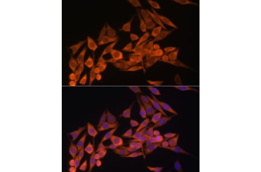Immunofluorescence - Anti-PTEN Antibody (A13881) - Antibodies.com