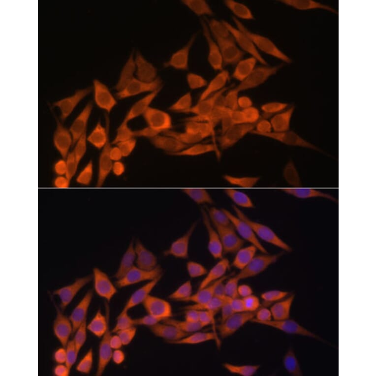 Immunofluorescence - Anti-PTEN Antibody (A13881) - Antibodies.com