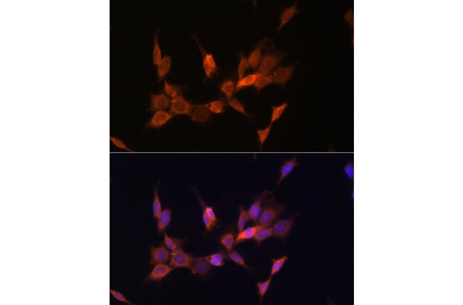 Immunofluorescence - Anti-PTEN Antibody (A13881) - Antibodies.com