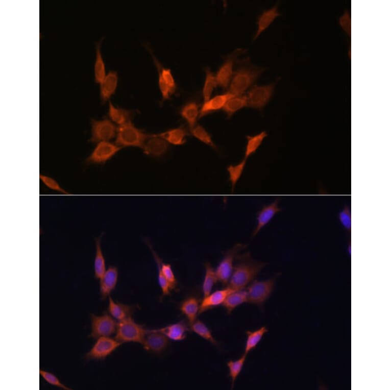 Immunofluorescence - Anti-PTEN Antibody (A13881) - Antibodies.com