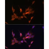 Immunofluorescence - Anti-PTEN Antibody (A13881) - Antibodies.com