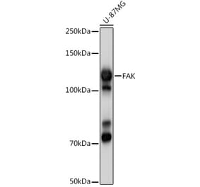 Western Blot - Anti-FAK Antibody (A13882) - Antibodies.com