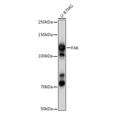 Western Blot - Anti-FAK Antibody (A13882) - Antibodies.com