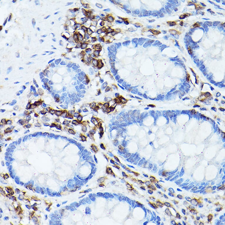 Immunohistochemistry - Anti-CD45 Antibody (A13883) - Antibodies.com