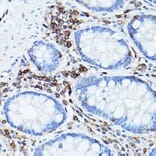 Immunohistochemistry - Anti-CD45 Antibody (A13883) - Antibodies.com