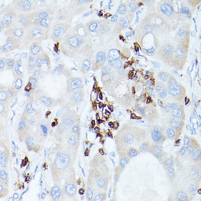 Immunohistochemistry - Anti-CD45 Antibody (A13883) - Antibodies.com