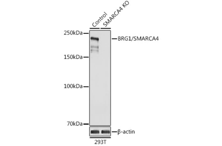 Western Blot - Anti-BRG1 Antibody (A13884) - Antibodies.com