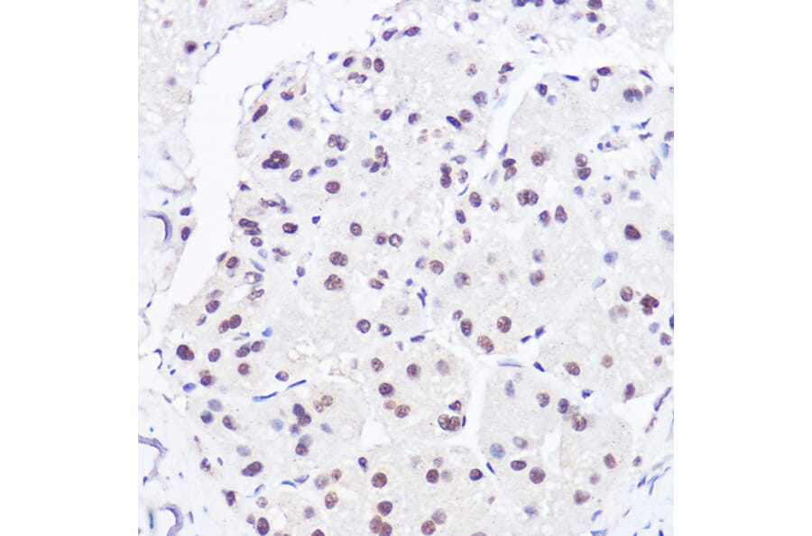 Immunohistochemistry - Anti-BRG1 Antibody (A13884) - Antibodies.com