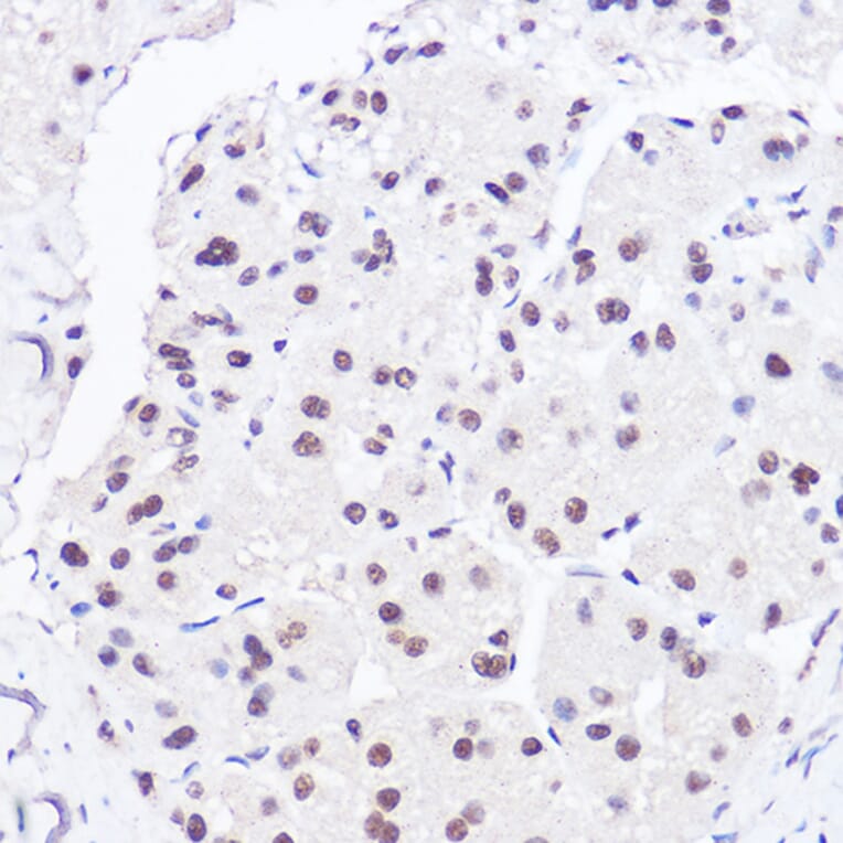 Immunohistochemistry - Anti-BRG1 Antibody (A13884) - Antibodies.com